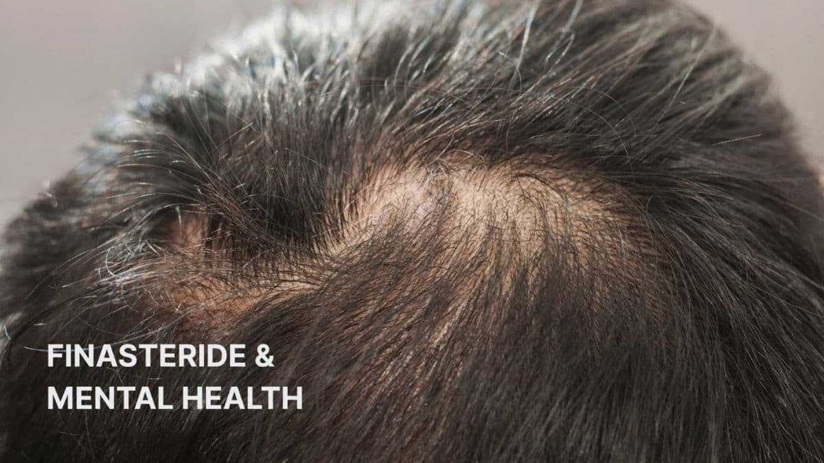 The Unspoken Connection: Understanding Finasteride and Mental Health